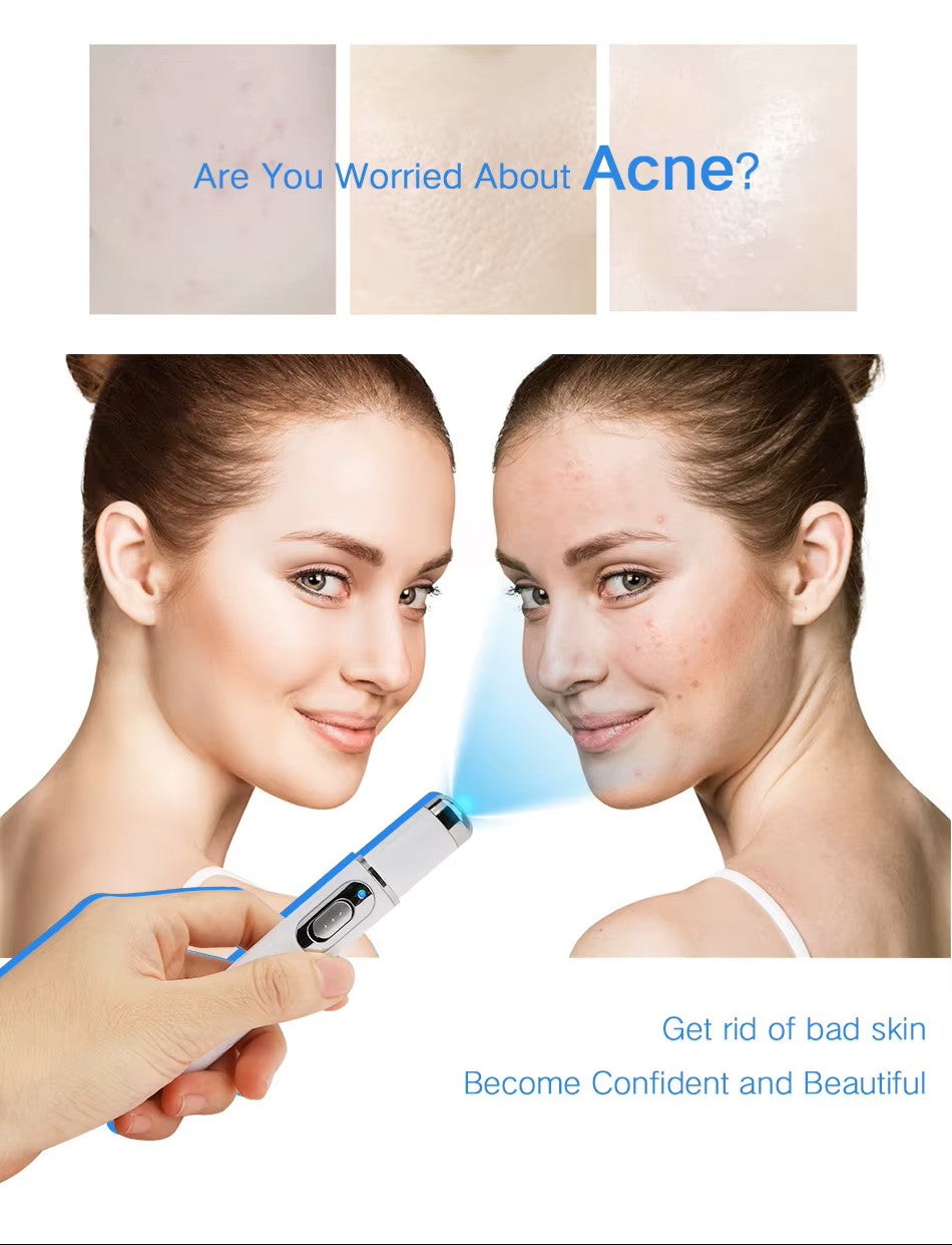 Acne Remove Blue-Light Laser Pen