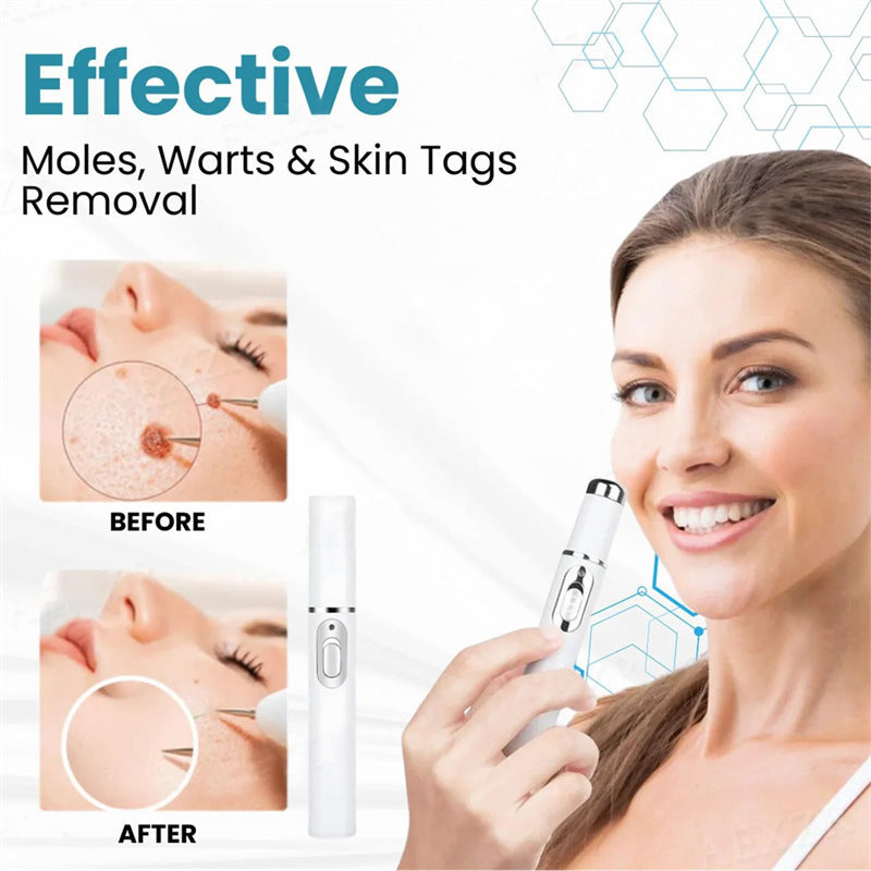 Acne Remove Blue-Light Laser Pen