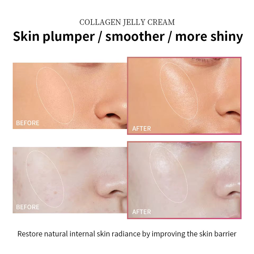 LAKERAIN Deep Hydrating Collagen Jelly Cream, Moisturizing, Tightening, Soothing Anti Aging, Firmness Hydration Cream Skincare